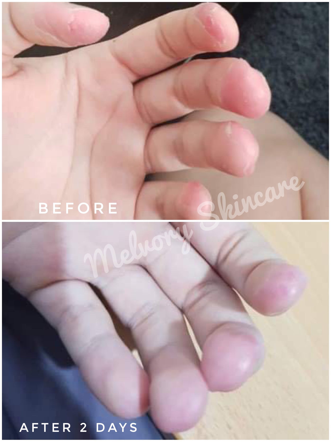 Raspberry Hand Cream – Melvory Store