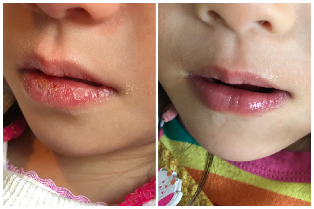 Avocado Nourishing Lip Butter