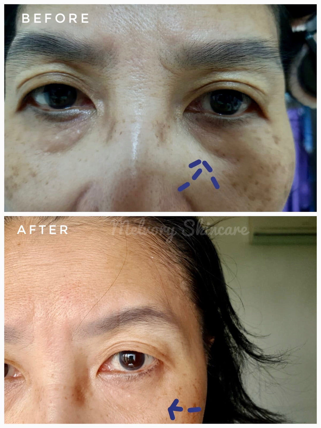 Ginseng Gold Serum
